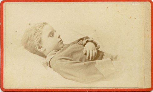 Post mortem CDV