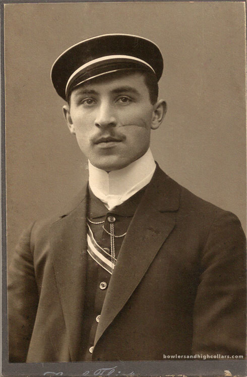 Scarred cheek German man. CDV. Private Collection.